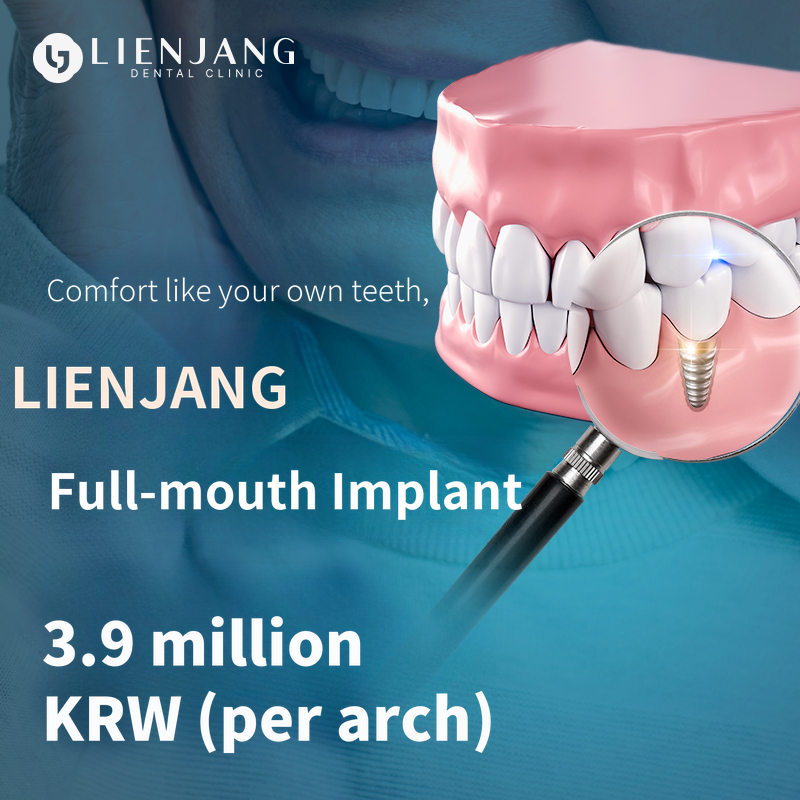 Comfortable full implant like my own teeth