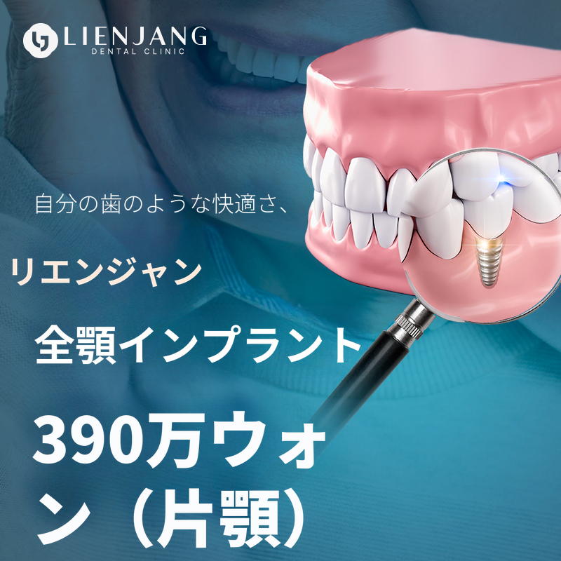 自分の歯のように快適な全体インプラント