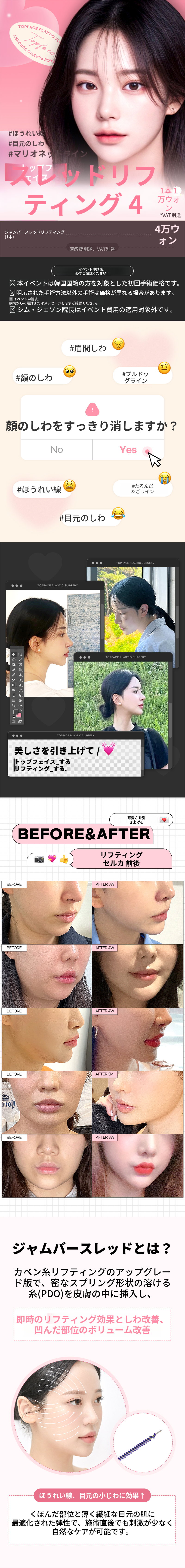 トップフェイス #ジャムバー シリフトアップ😎