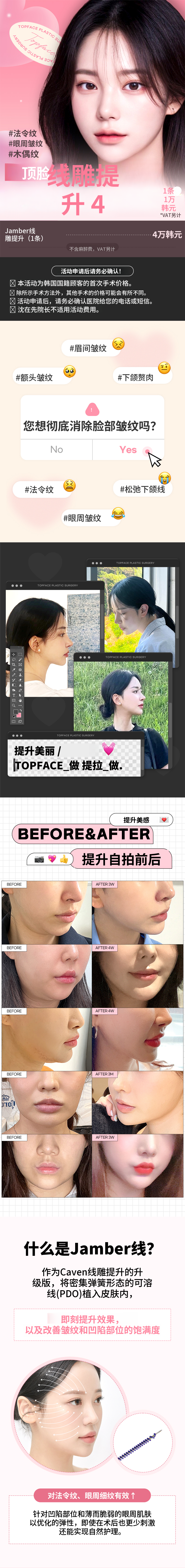 顶脸 #Jamber 硅胶提升😎