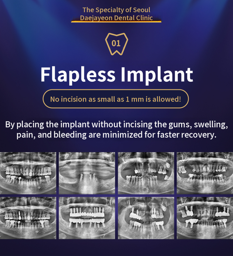 Minimal incision, quick recovery Seoul The Natural Implant