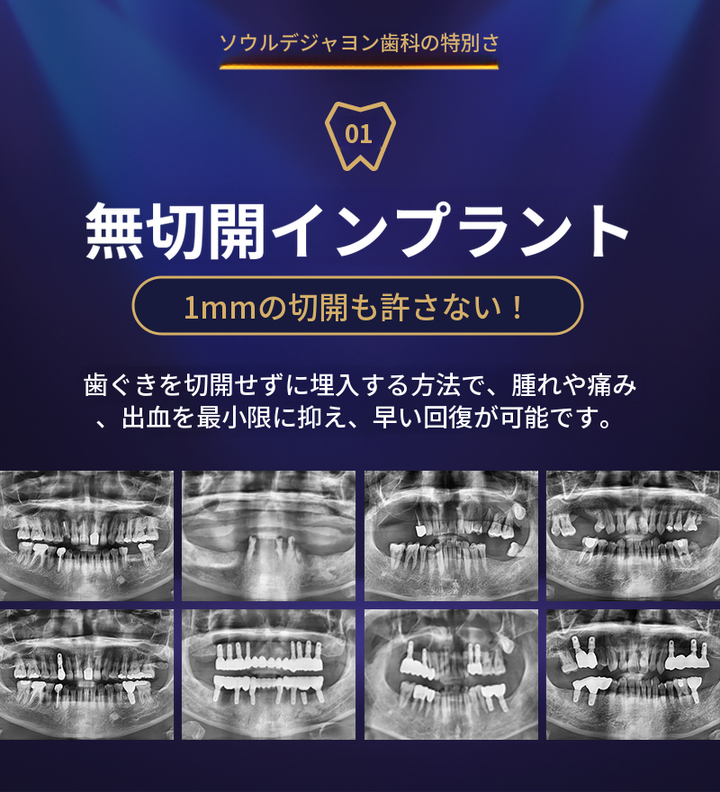 最小切開、迅速回復 ソウルザナチュラルインプラント