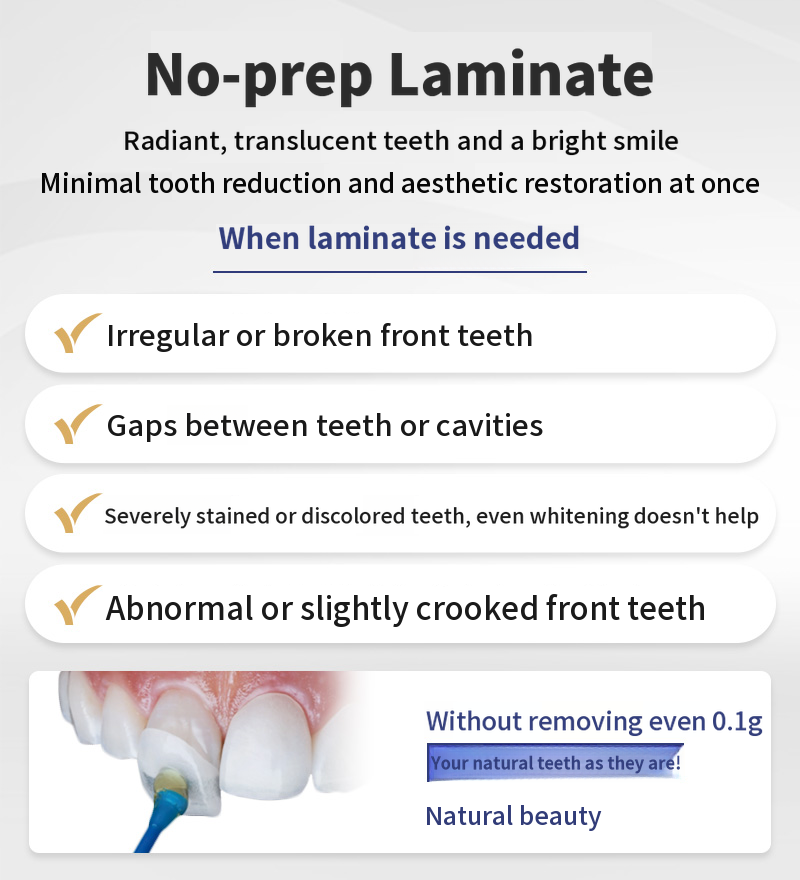 Natural Beauty, No-Removal Laminate