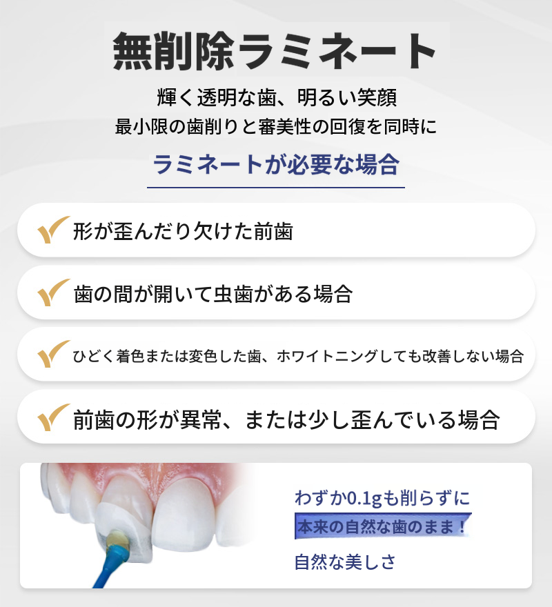 自然な美しさ、無削除ラミネート