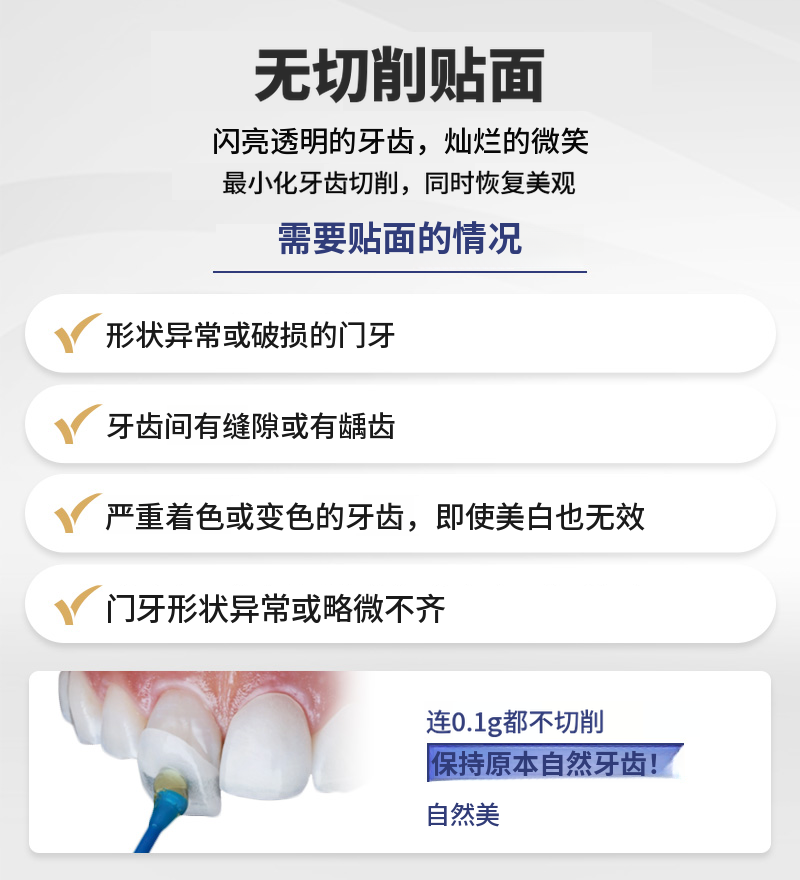 自然之美，无删除贴面