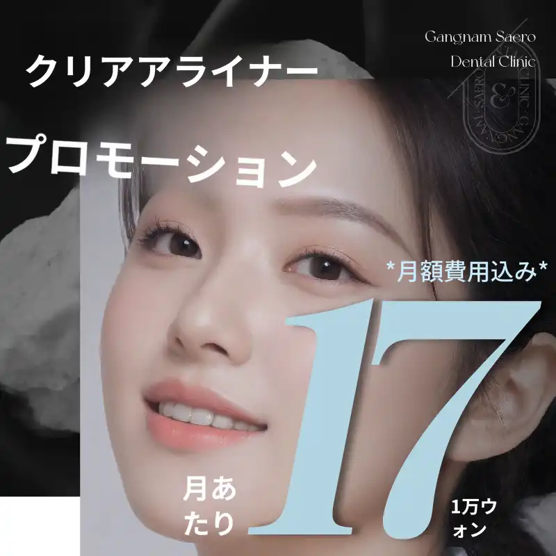 月額払い透明矯正プロモーション