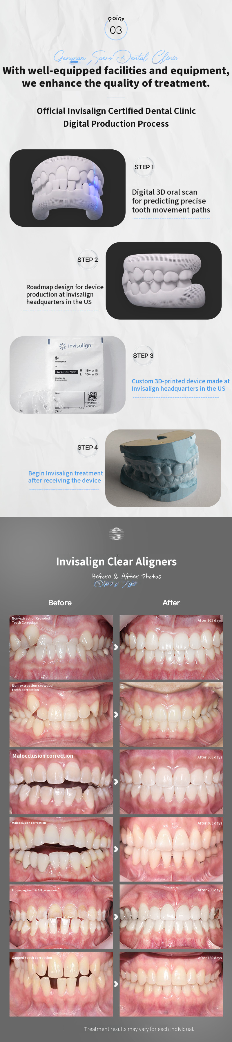 Smart Choice: Invisalign Express