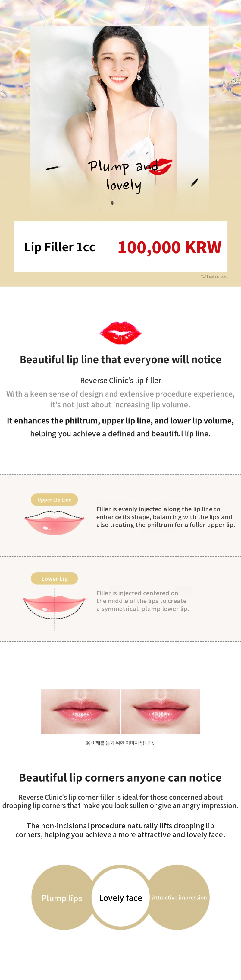 Lip Filler for Fuller Lips