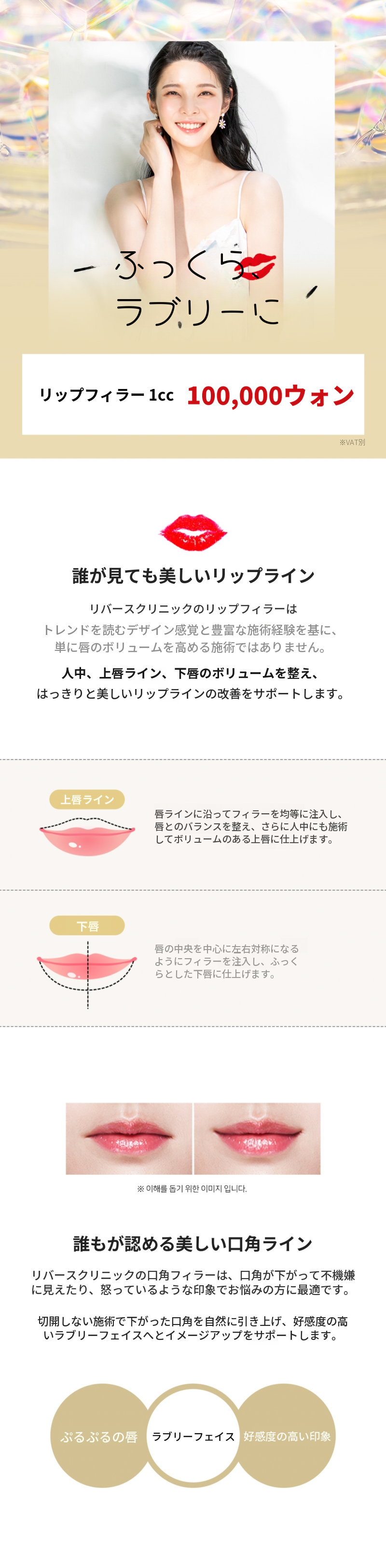 唇をふっくらとさせるリップフィラー