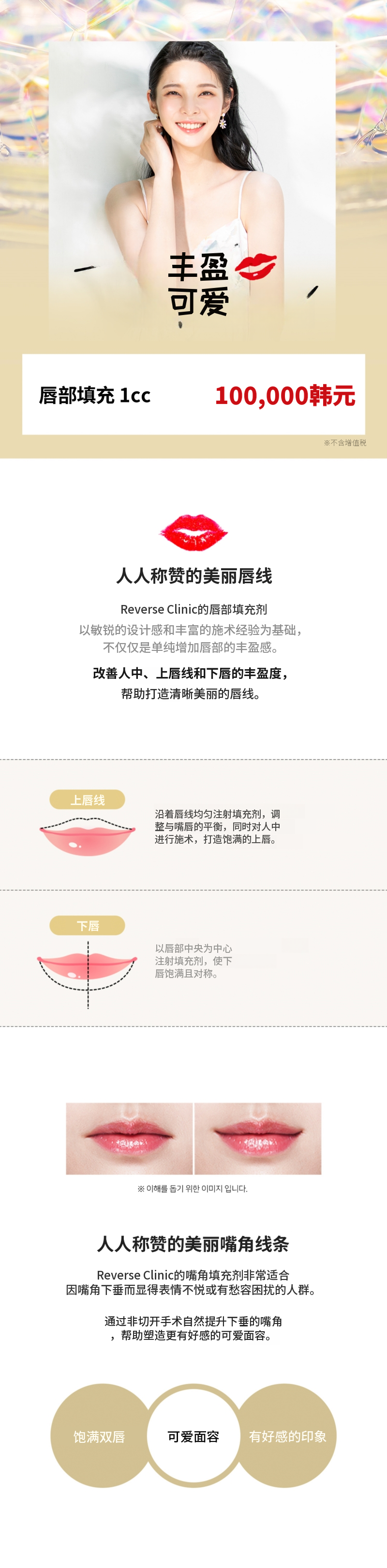 丰唇填充剂