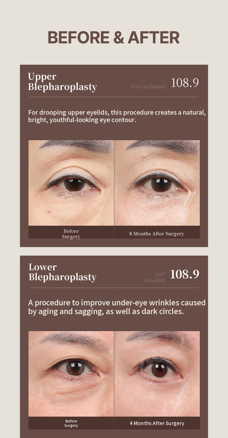 ❤️View❤️ Eye Surgery for Middle-Aged Patients