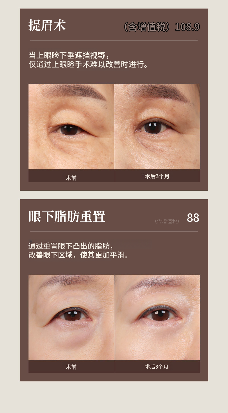 ❤️美❤️中年眼部整形