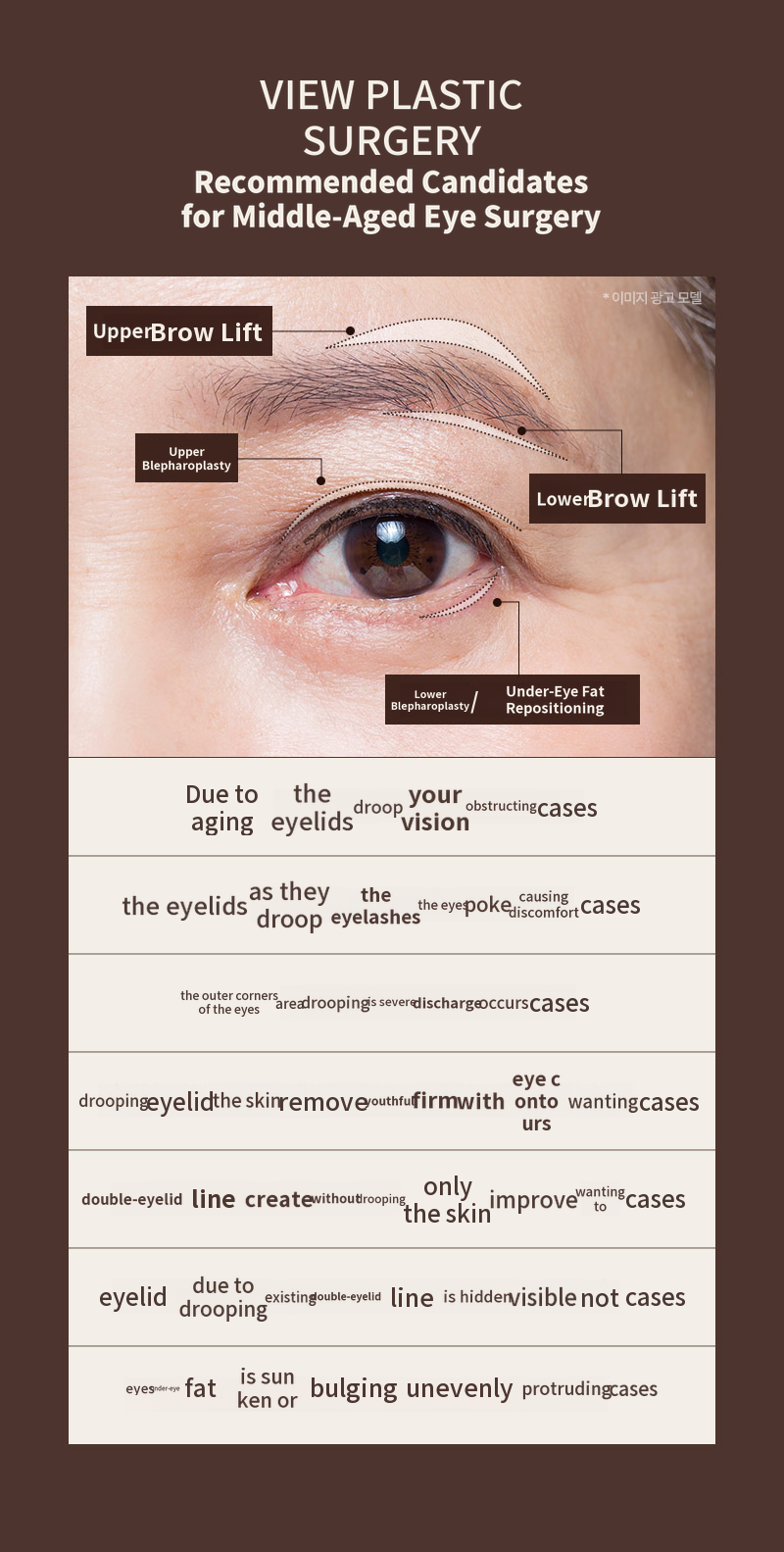 ❤️View❤️ Eye Surgery for Middle-Aged Patients