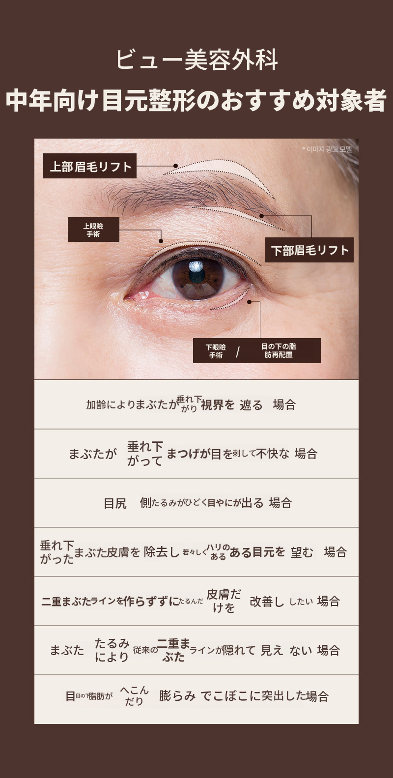 ❤️ビュー❤️中高年の目元整形