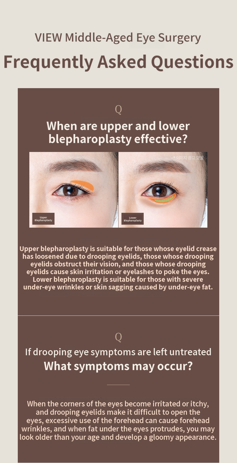 ❤️View❤️ Eye Surgery for Middle-Aged Patients