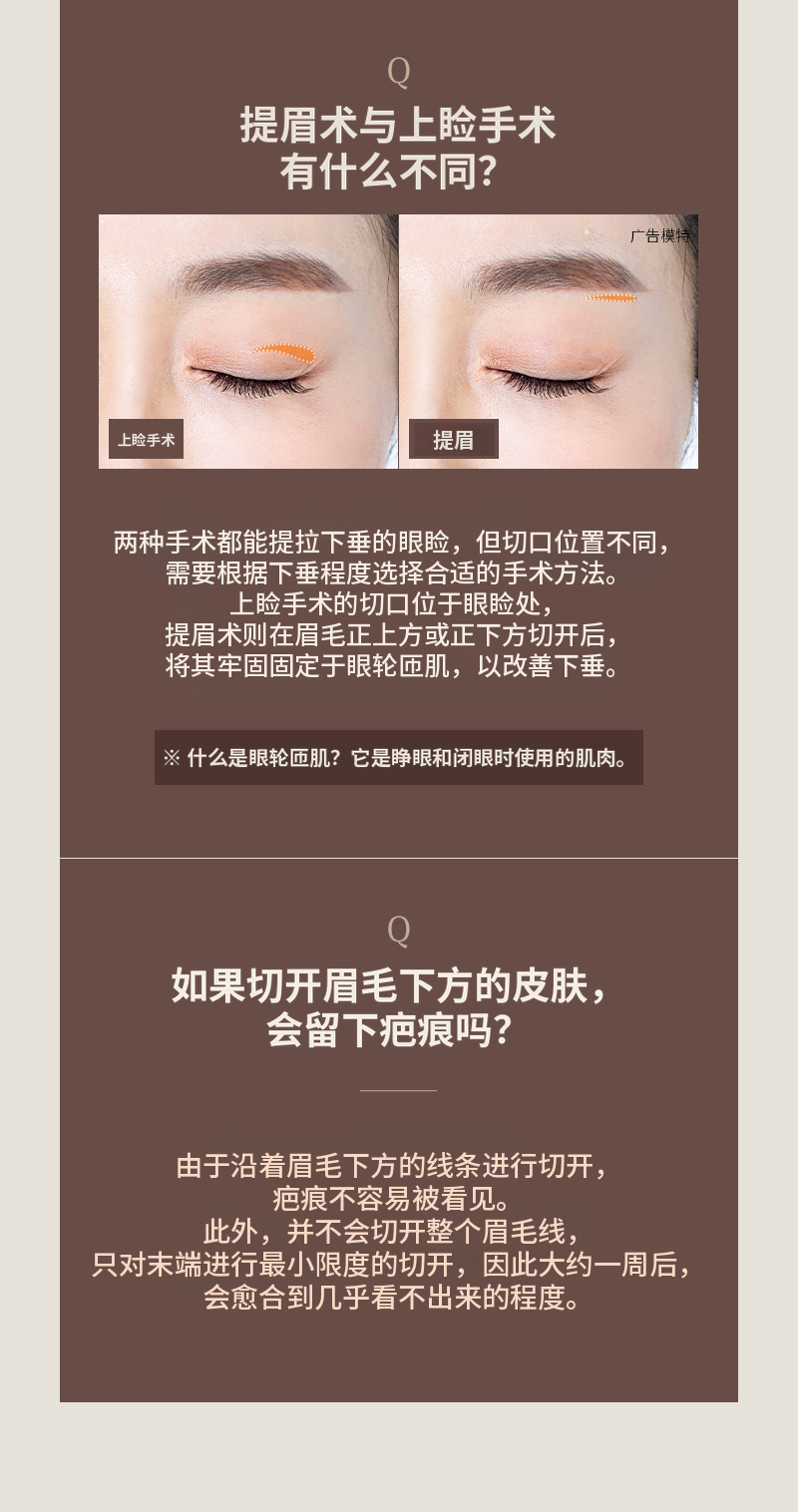 ❤️美❤️中年眼部整形