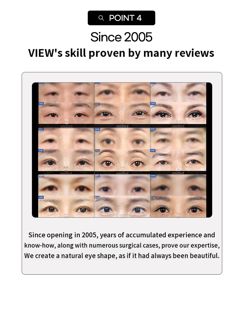 ❤️View❤️Middle-aged Eye Surgery