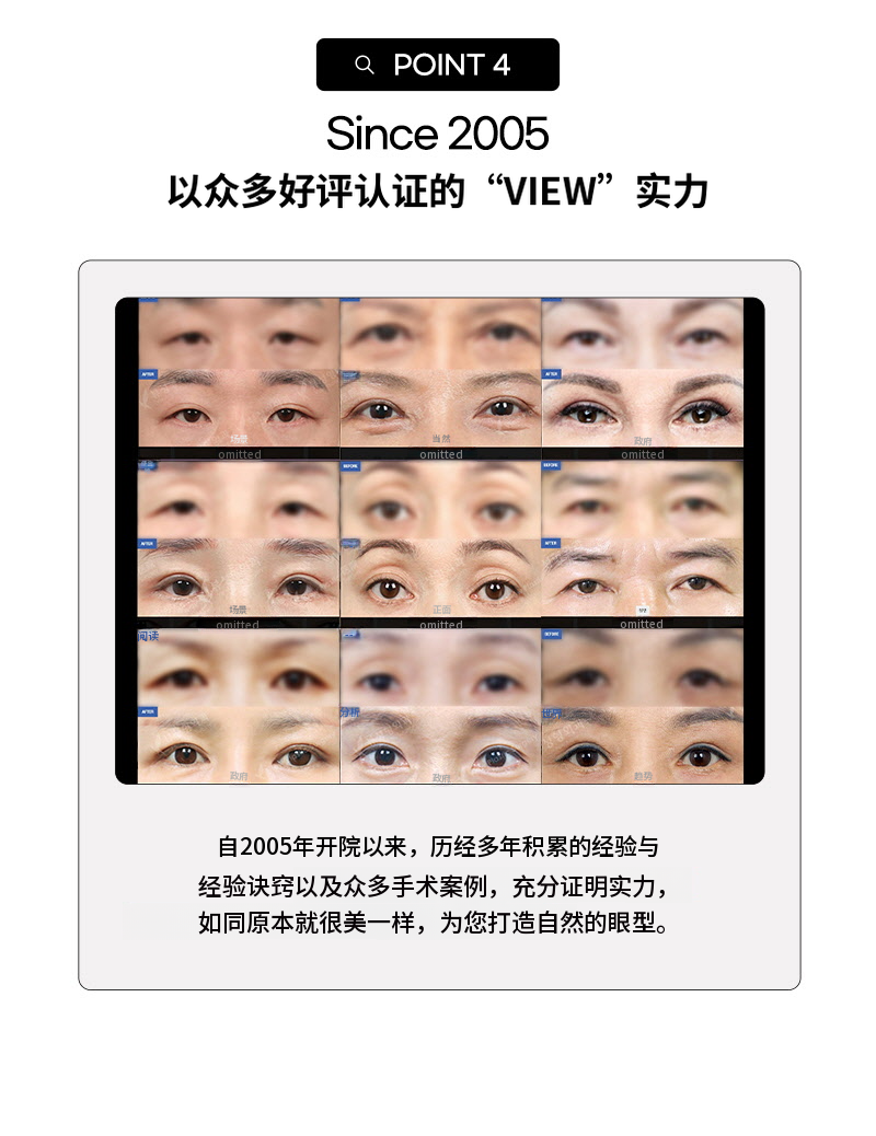 ❤️视❤️中年眼部整形