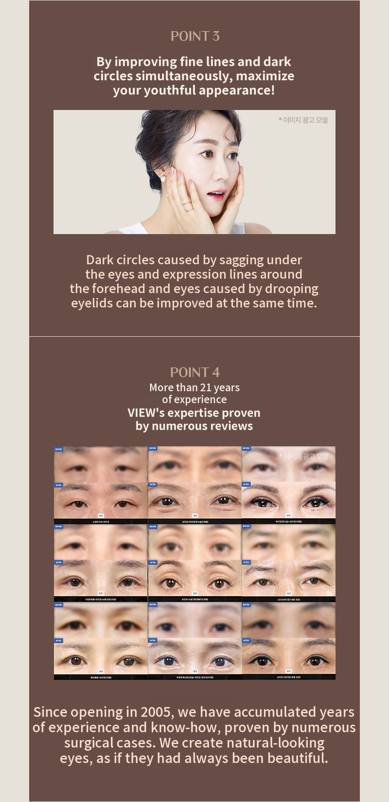 ❤️View❤️ Eye Surgery for Middle-Aged Patients