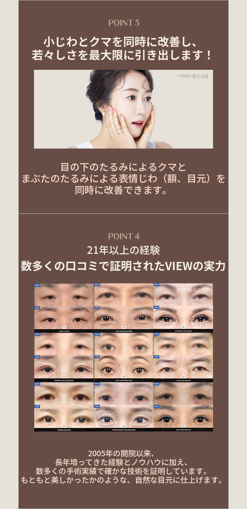 ❤️ビュー❤️中高年の目元整形