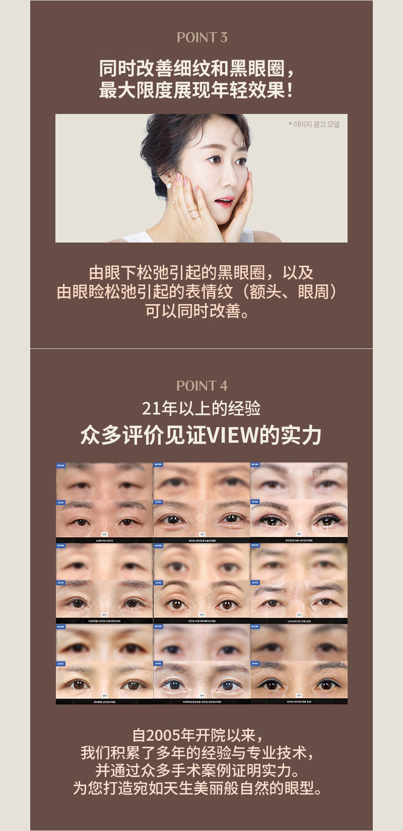 ❤️美❤️中年眼部整形