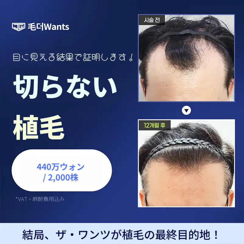 傷跡最小化、非切開毛髪移植 