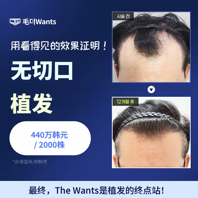 最小化疤痕，无切口毛发移植