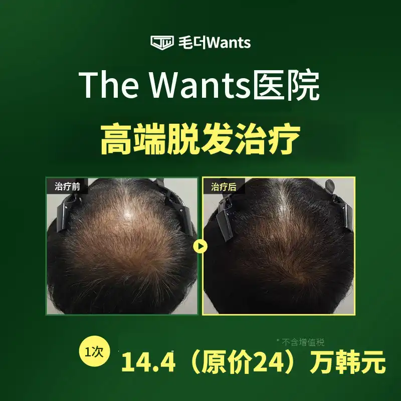高级脱发治疗♥