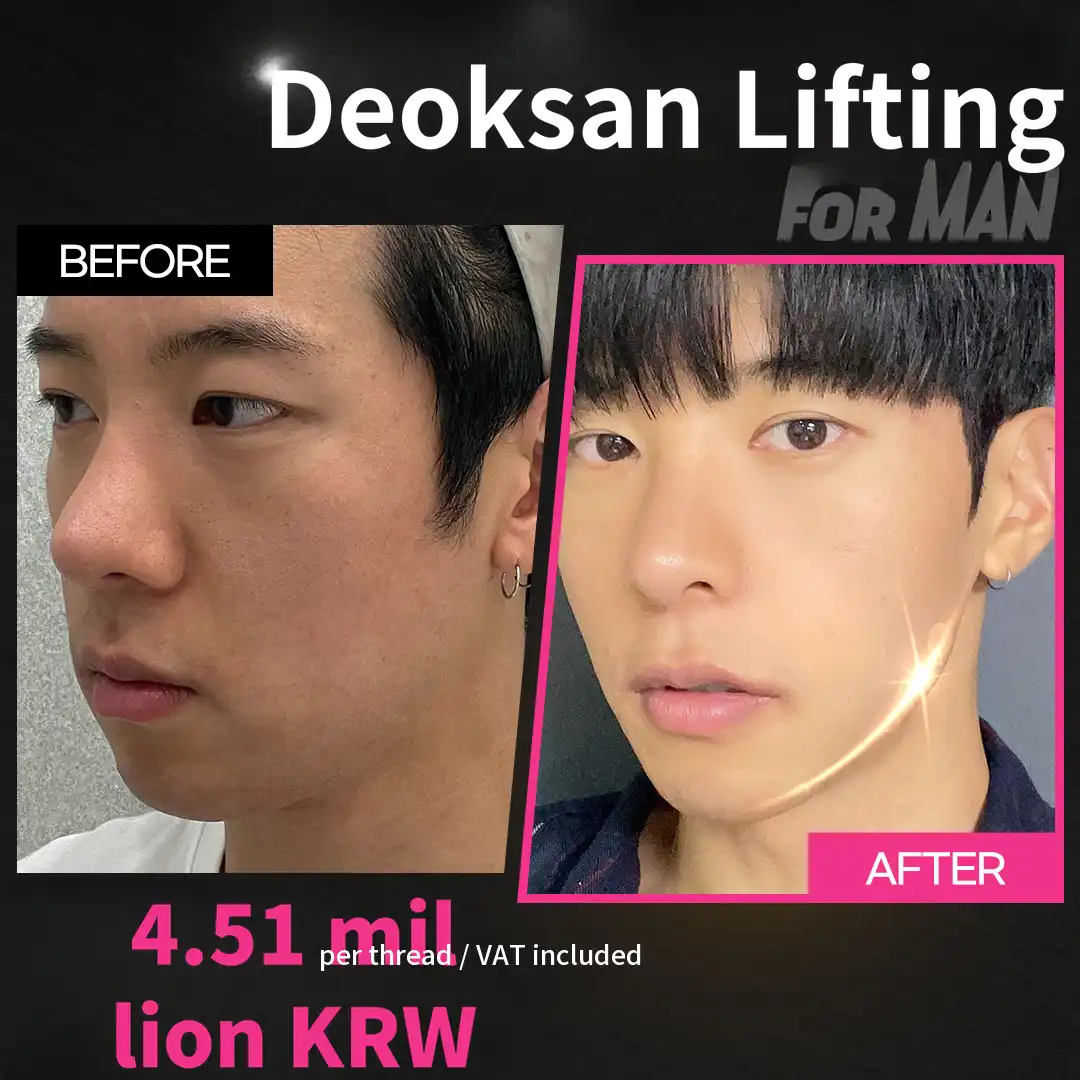 The completion of a man is the jawline! Jawline Lifting for MAN