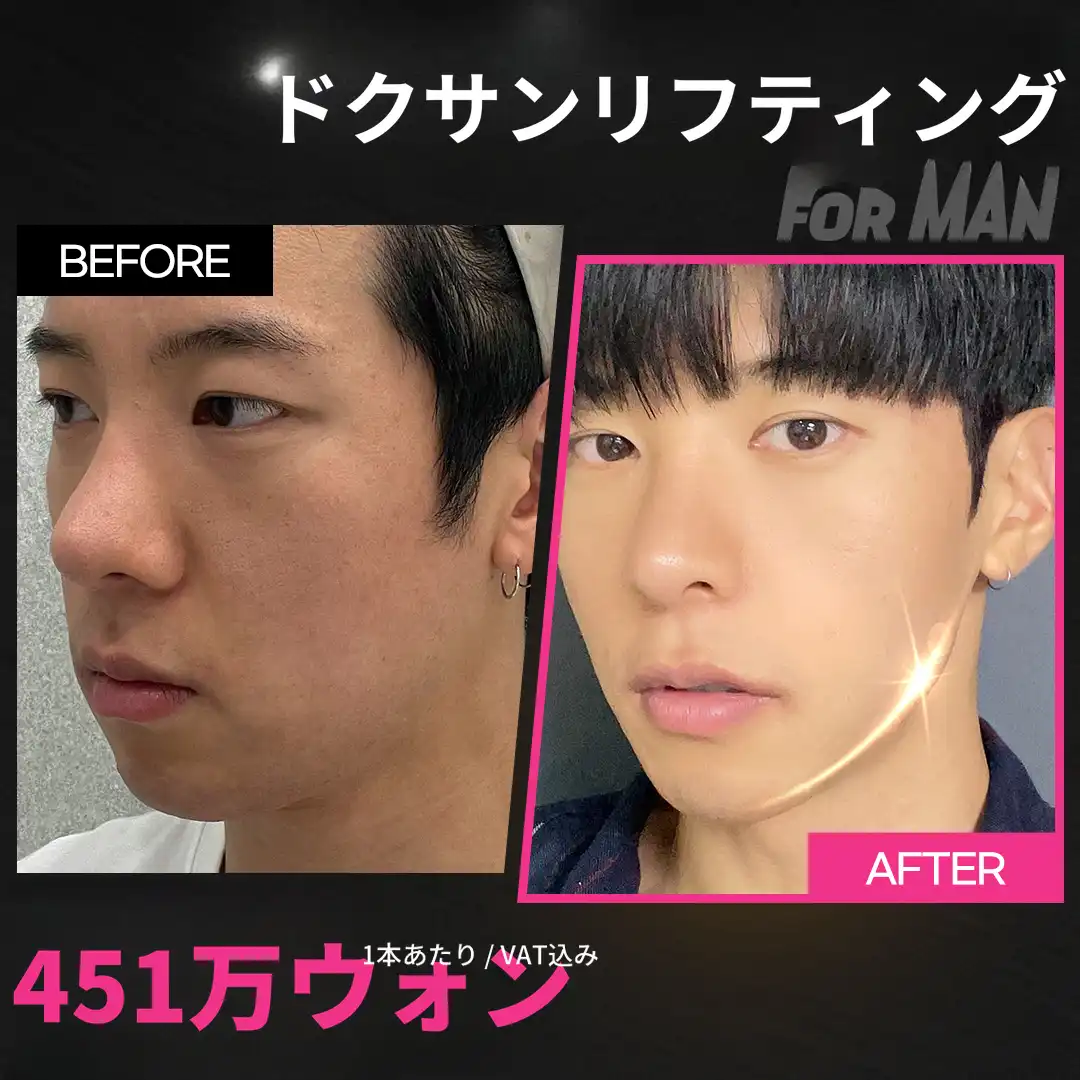 男の完成はあごのライン！男性のためのあごラインリフト