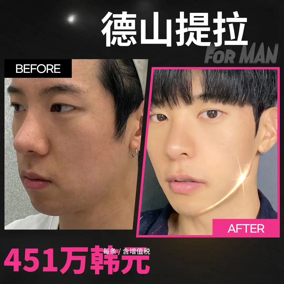 男人的完美来自于下巴线！男士下巴线提升