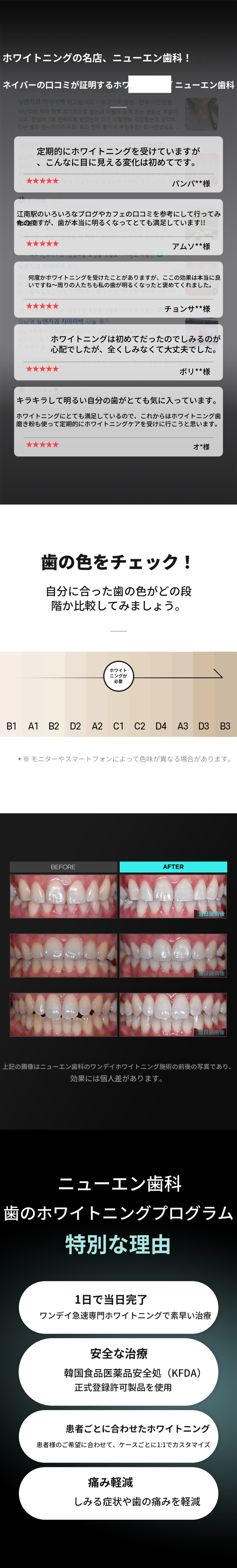 白い微笑み、ホワイトニングの専門店ニュエン歯科！