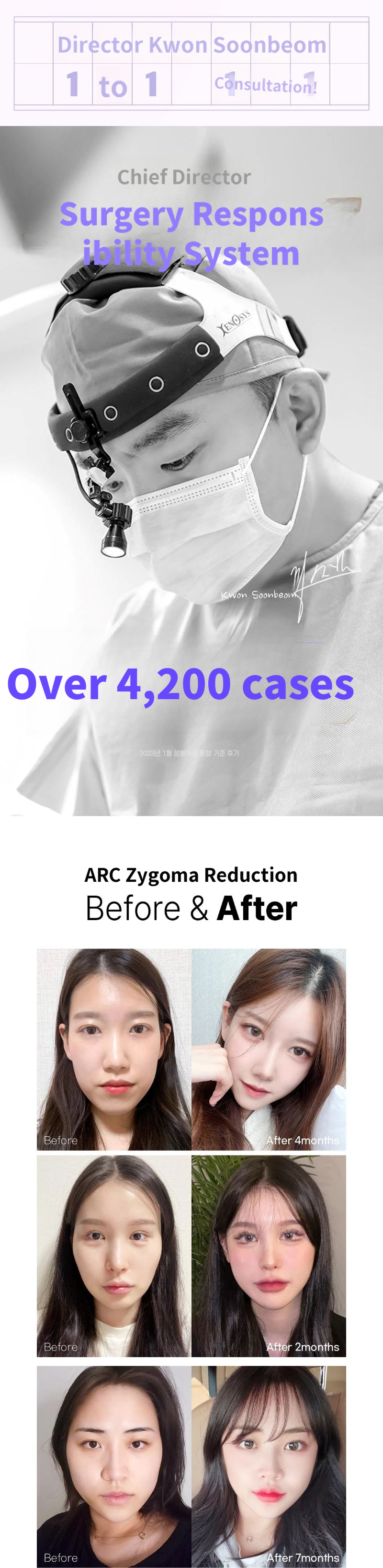 Arc_Cheekbone Reduction