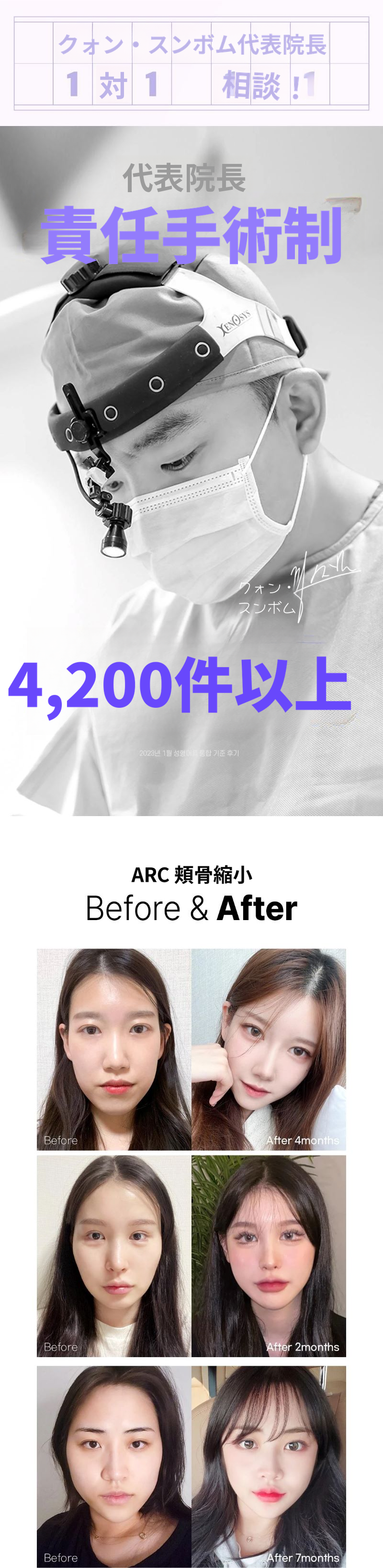 アーク_頬骨縮小