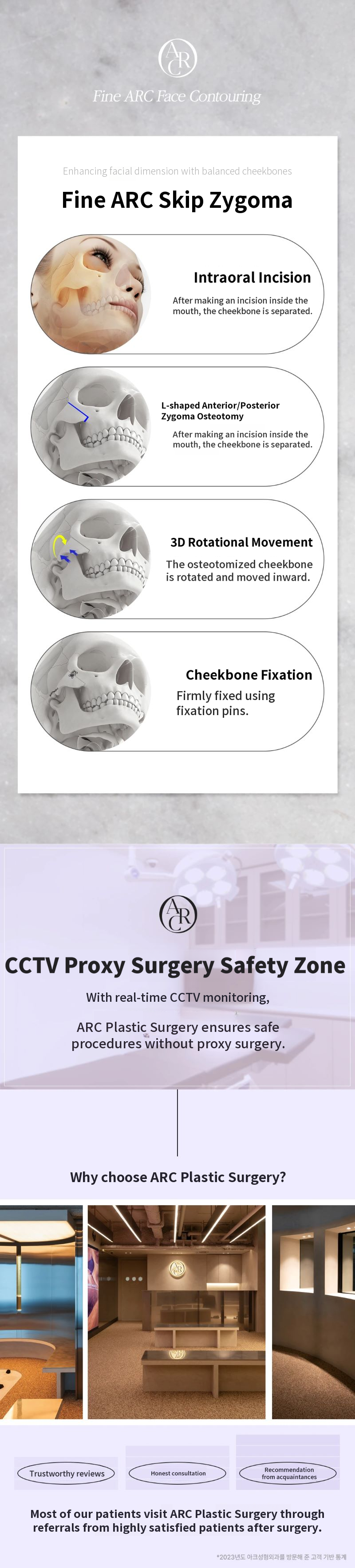 Arc_Cheekbone Reduction