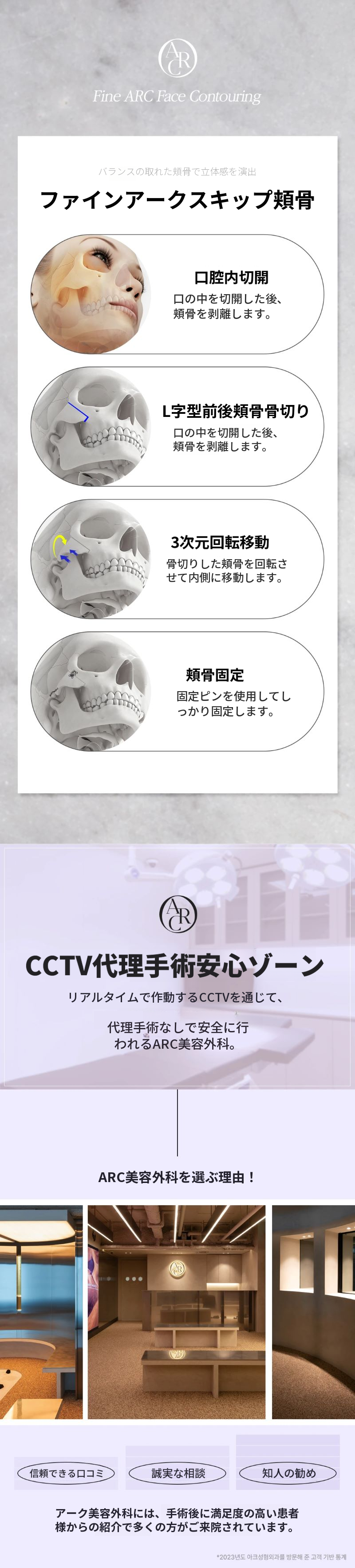 アーク_頬骨縮小