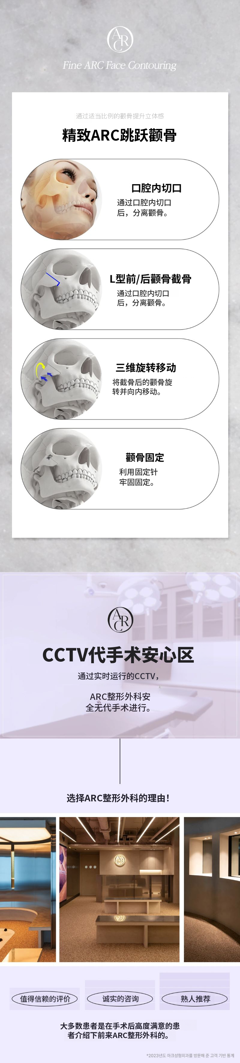 Aqua_颧骨缩小