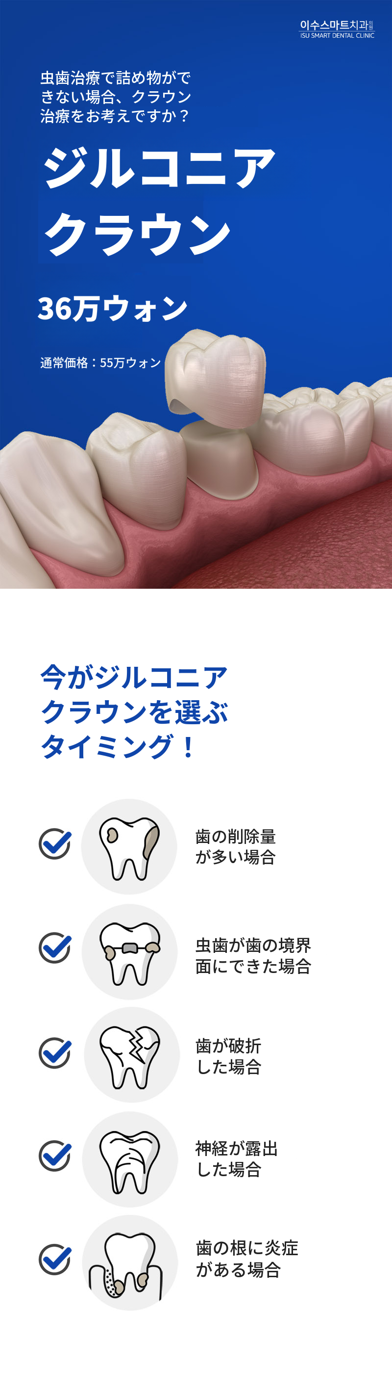 ジルコニアクラウン虫歯治療