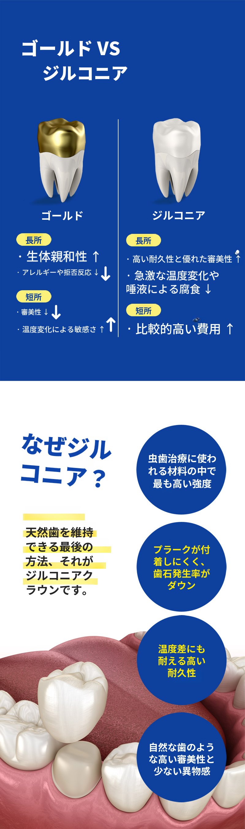 ジルコニアクラウン虫歯治療