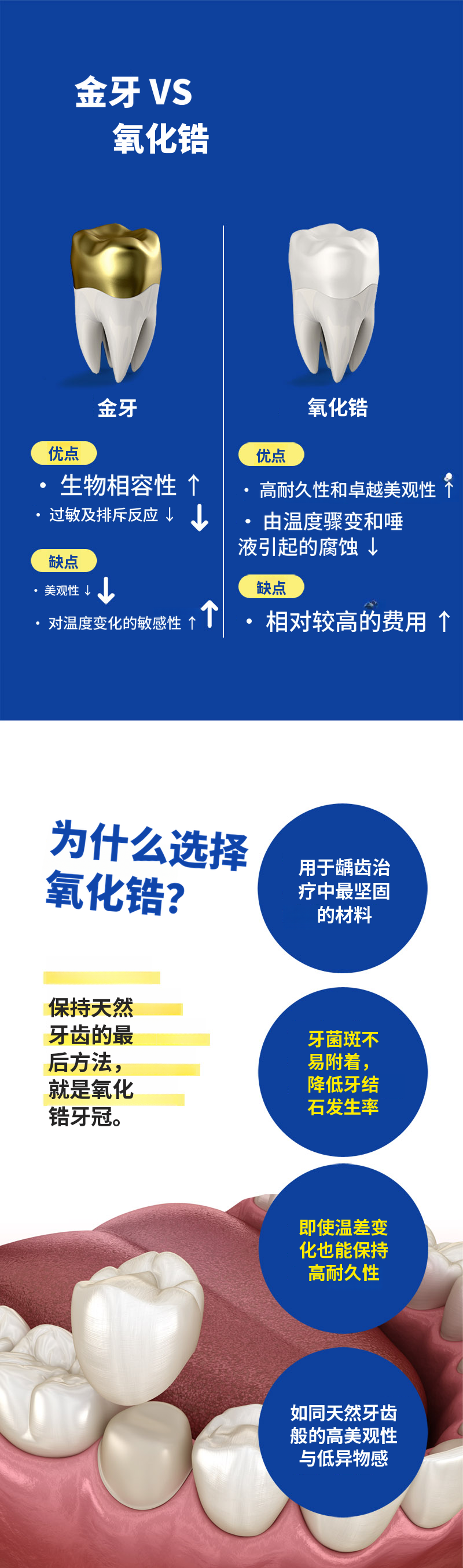锆石冠蛀牙治疗