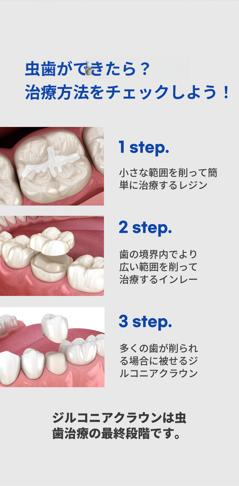 ジルコニアクラウン虫歯治療