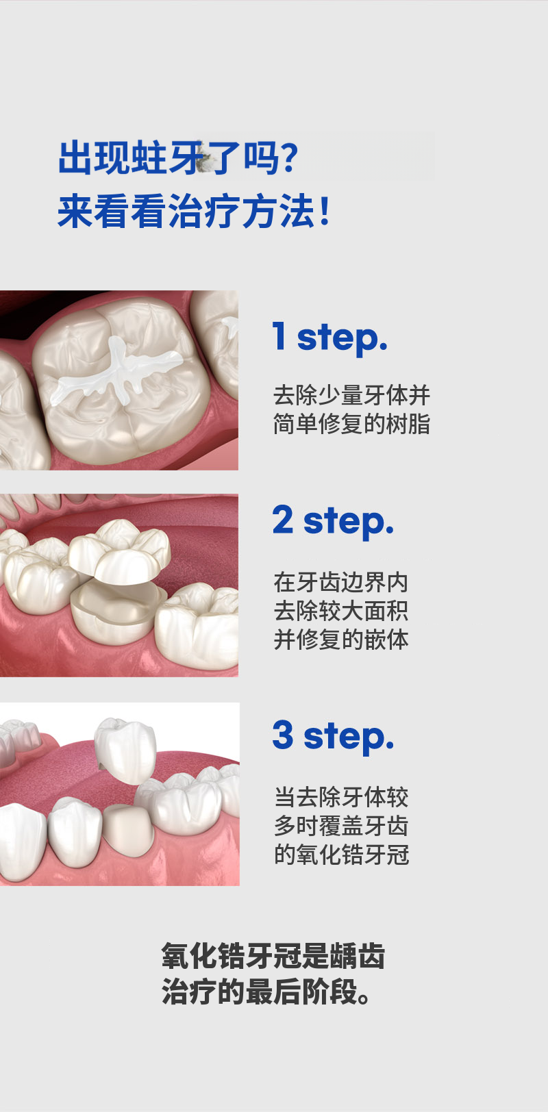 锆石冠蛀牙治疗