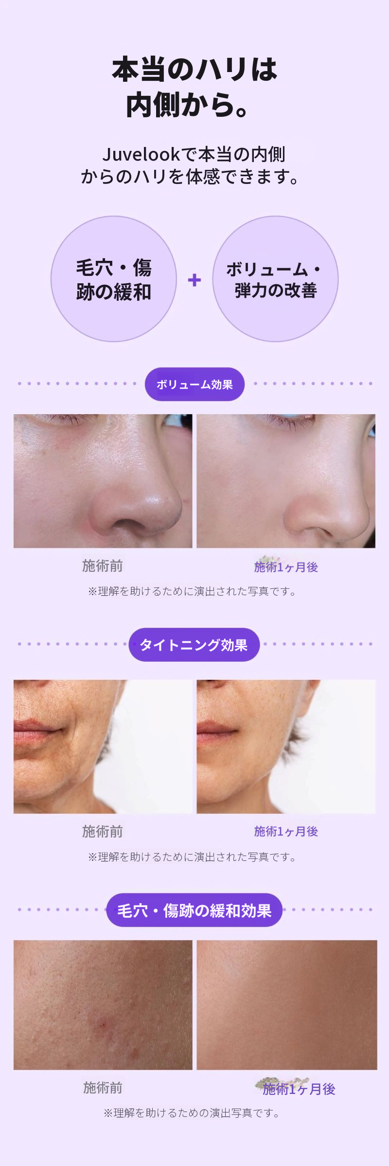 本来_ジュビラックボリューム&ジュビラック