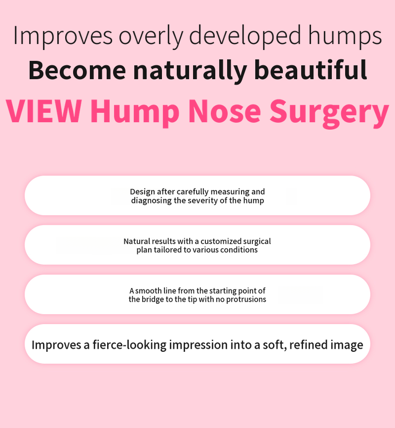 ❤️View❤️Nasal Surgery