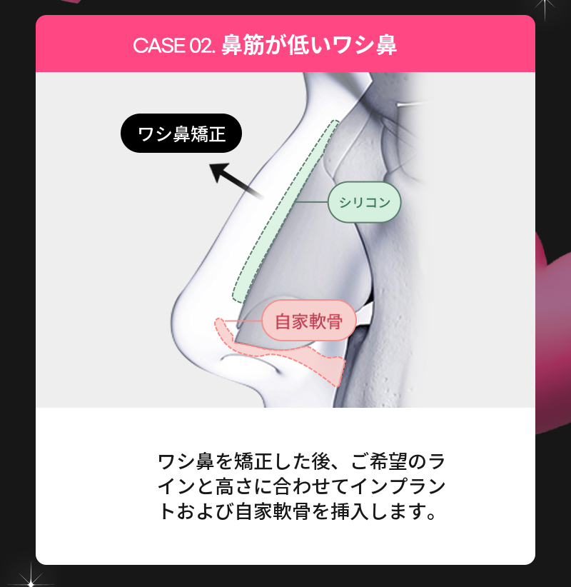 string