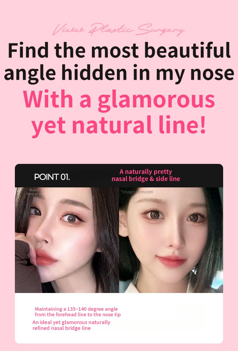 ❤️View❤️Nasal Surgery