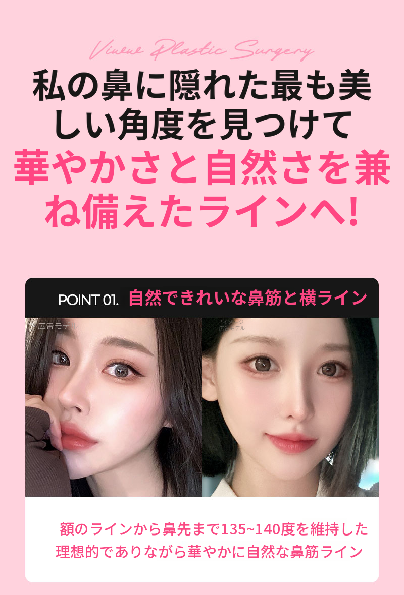 ❤️ビュー❤️わし鼻整形