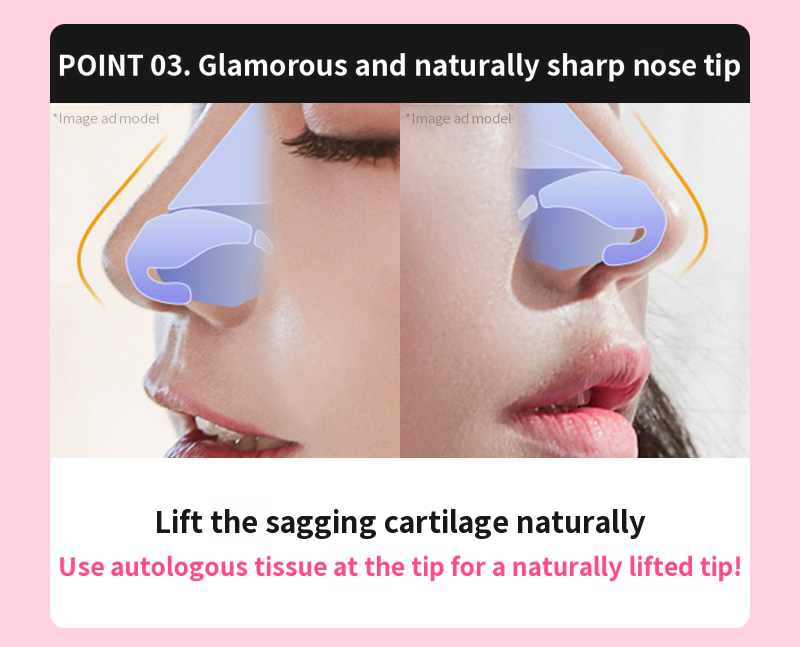 ❤️View❤️Nasal Surgery
