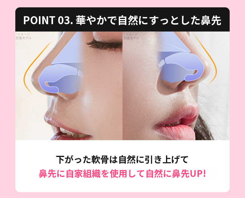 ❤️ビュー❤️わし鼻整形
