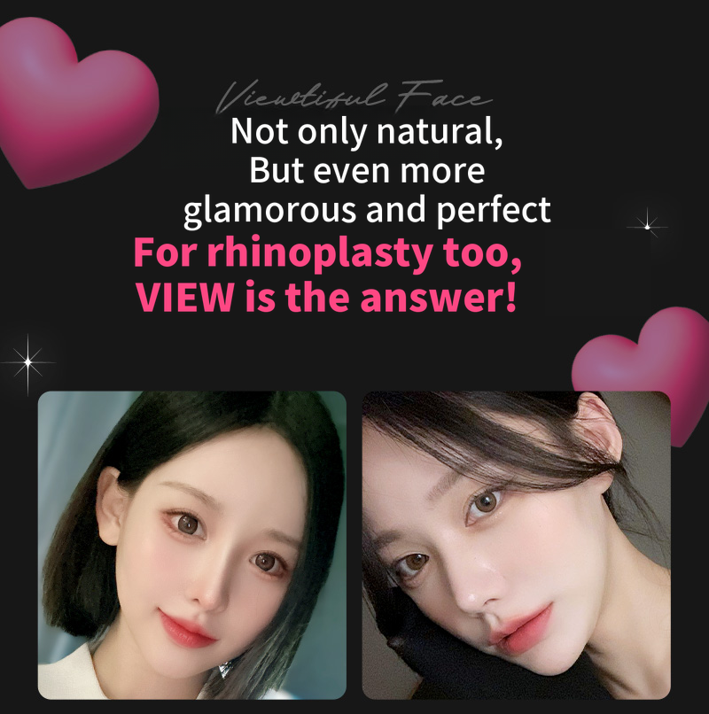 ❤️View❤️Nasal Surgery